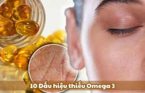 Dấu hiệu thiếu Omega-3