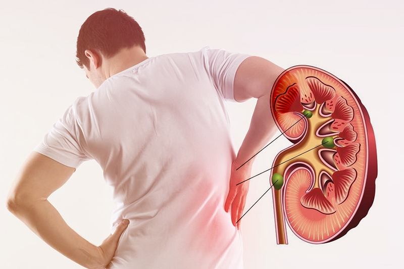 Dấu Hiệu Suy Thận Giai Đoạn Đầu