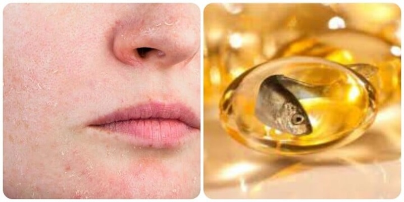 Dấu hiệu 1: Da Khô Và Bong Tróc
